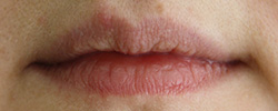 Фото до перманентного макияжа губ