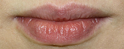 Фото до перманентного макияжа губ