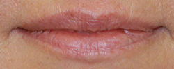 Фото до перманентного макияжа губ