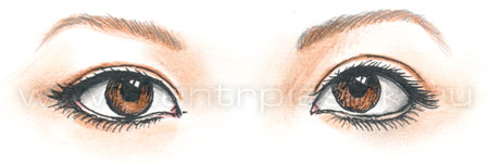 Коррекция азиатского разреза глаз