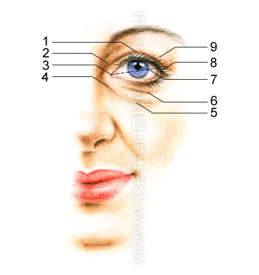 Блефаропластика