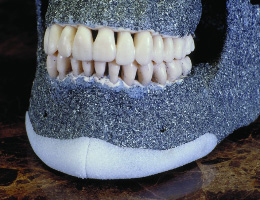 Пластика подбородка