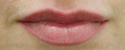 Перманентный макияж губ