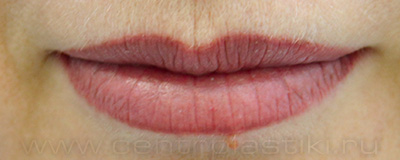 Перманентный макияж губ