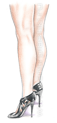 Круропластика