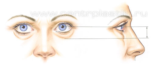 Операции на веках