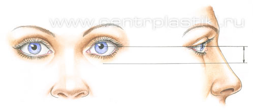 Операции на веках