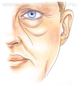 Операции на веках