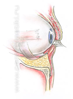 Операции на веках