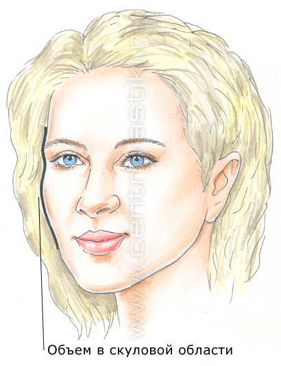 Эндоскопическая подтяжка лица