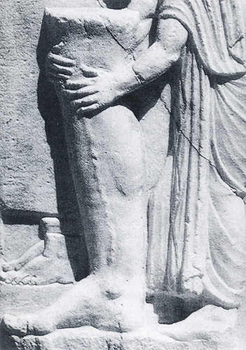 Лечение варикозной болезни