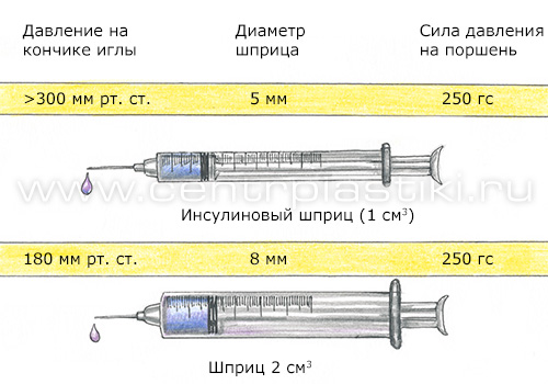 Сосудистые звездочки