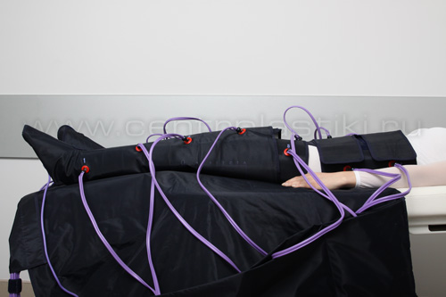 Лечение варикоза