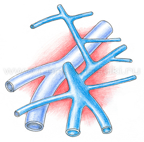 Флебэктомия