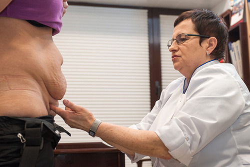 Абдоминопластика