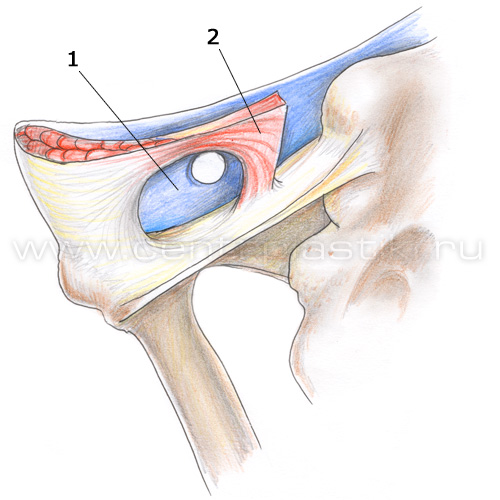 Паховая грыжа. Анатомия пахового канала