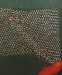 Эндопротез