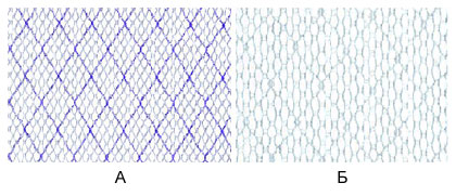 Эндопротез