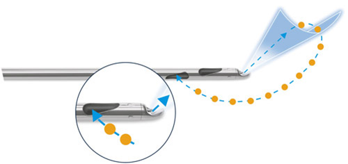 Body-Jet - водоструйная липосакция
