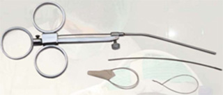 Полипы - удаление