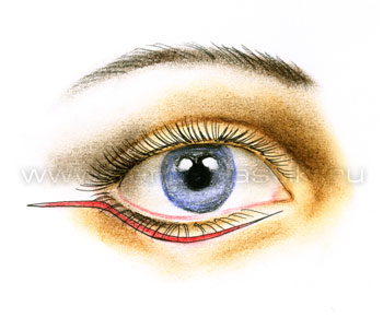 Подтяжка средней зоны лица