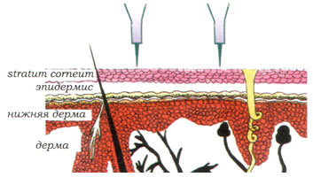 Контурный макияж