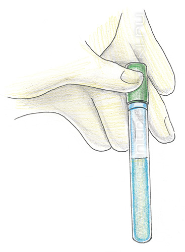 Плазмолифтинг