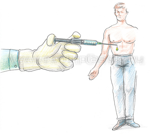 Плазмолифтинг