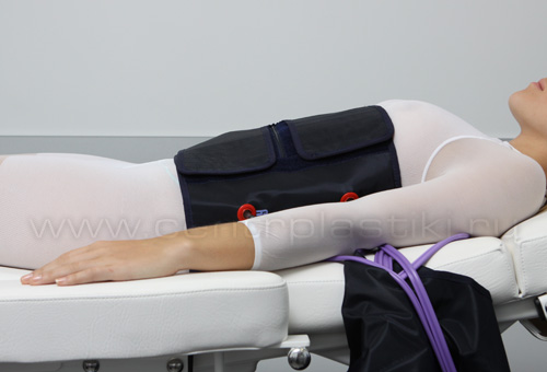 Прессотерапия