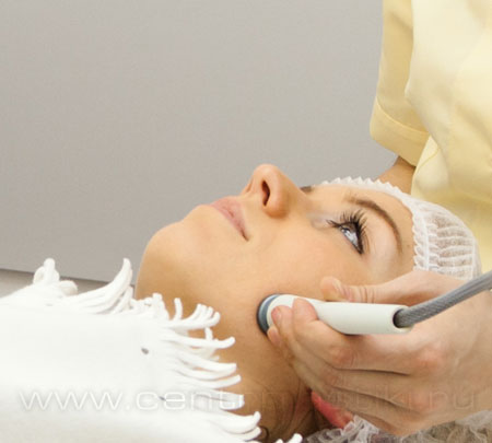 Радиочастотный (RF) лифтинг