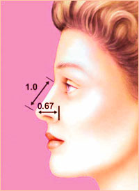 Пластика носа - Форма носа 2