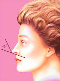 Пластика носа - Форма носа 4