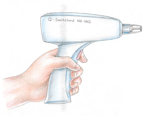 Удаление перманентного макияжа