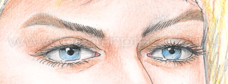 Удаление перманентного макияжа