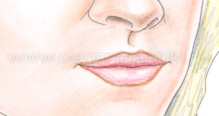 Удаление перманентного макияжа