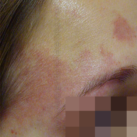 Удаление винных пятен