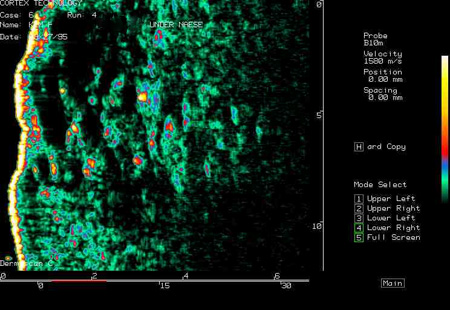 Удаление винных пятен