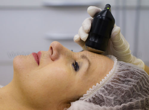 Ультразвуковая терапия