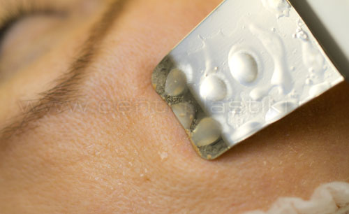 Ультразвуковая чистка лица